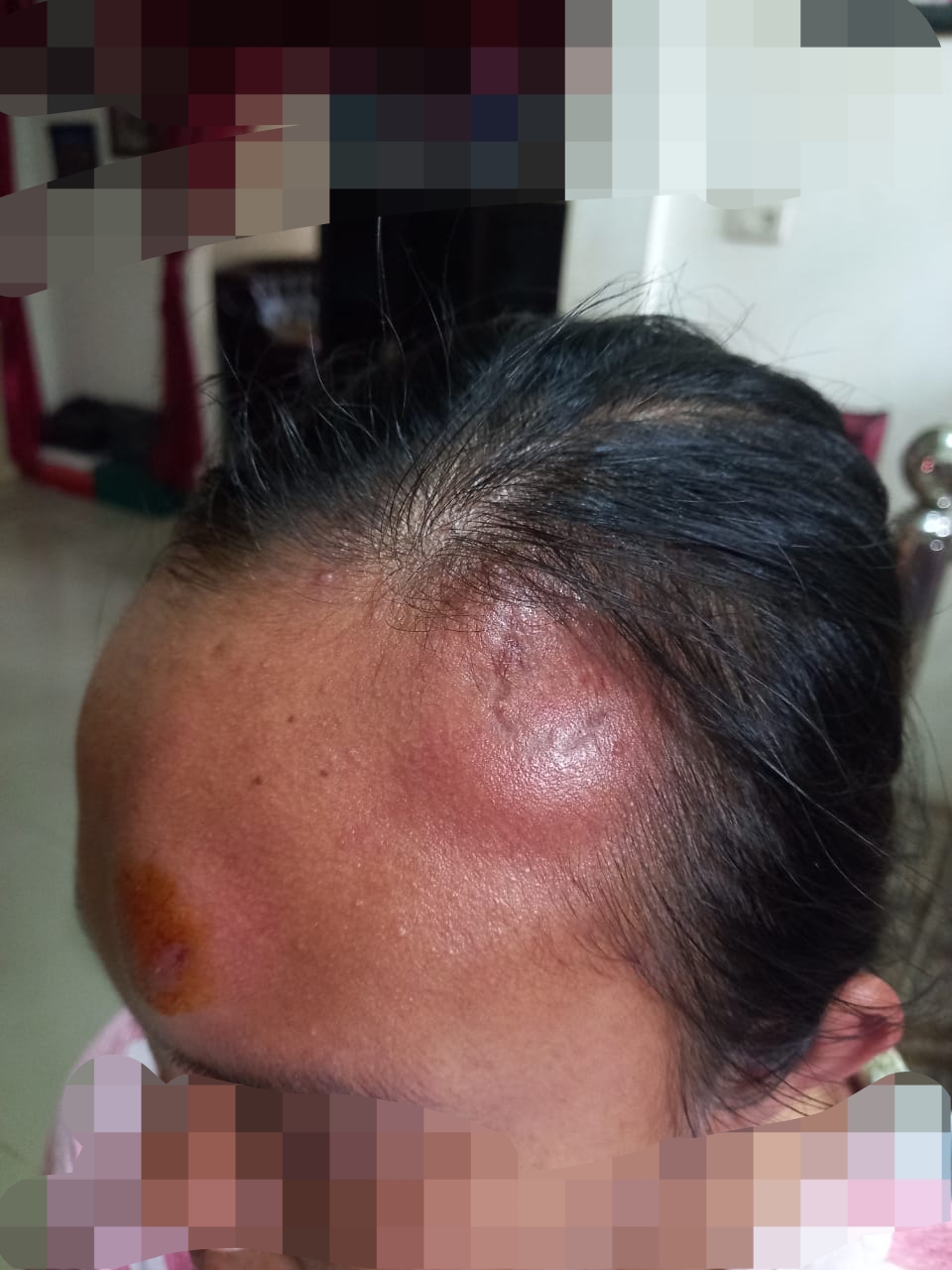 Lapor ke Polres Lahat, Pelajar SMAN 1 Merapi Barat yang dikeroyok sampai benjol